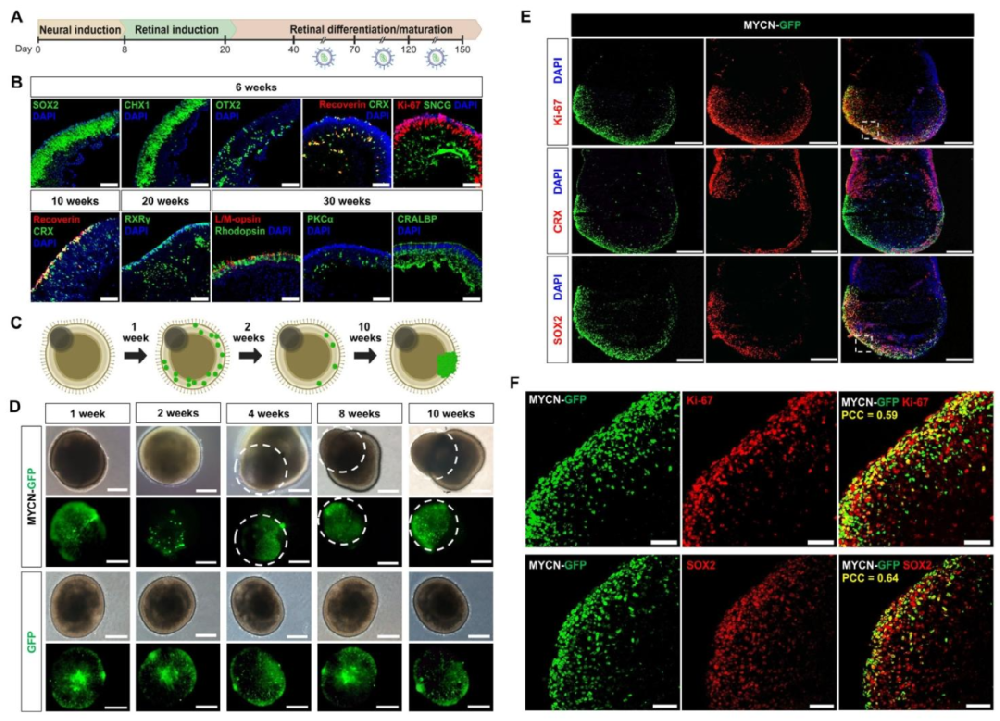 图 1：MYCN 过表达类器官的致瘤性与细胞特征