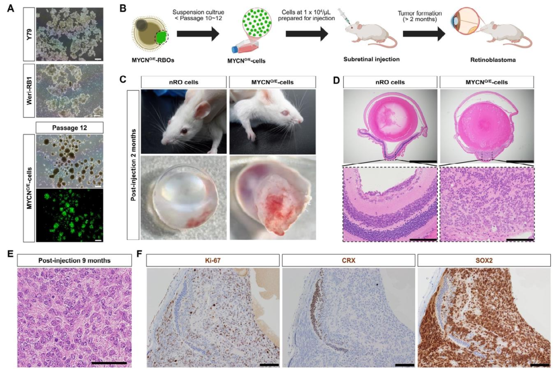 图 2：MYCN⁺细胞系的建立与体内致瘤性
