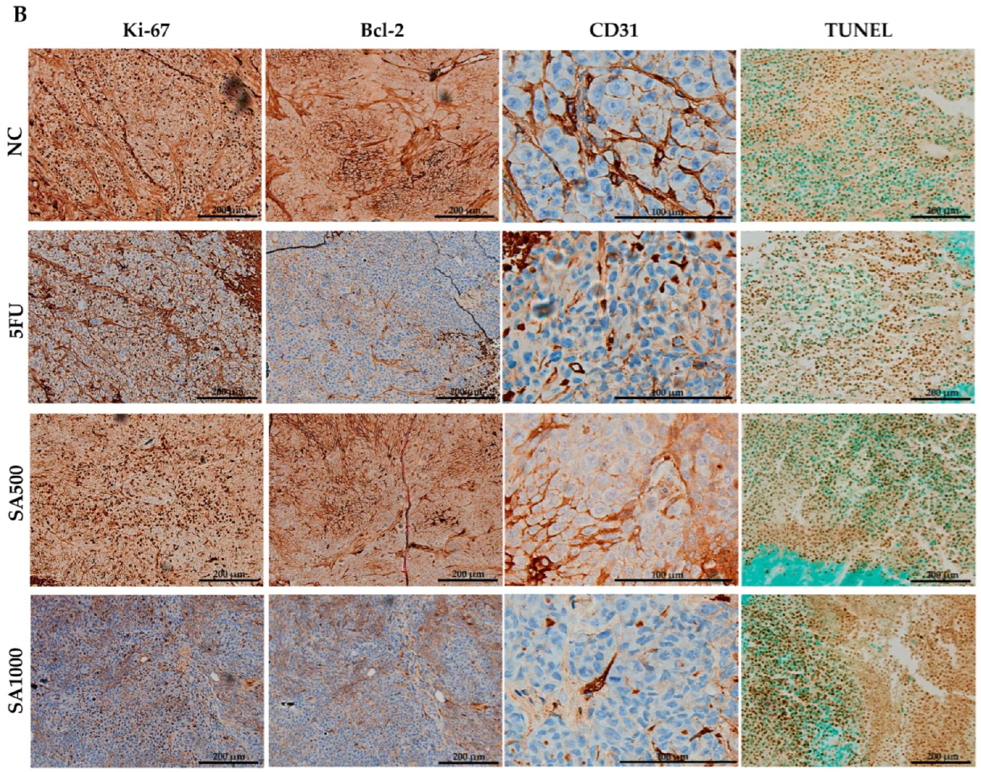 图6 肿瘤组织的免疫组化与 TUNEL 分析