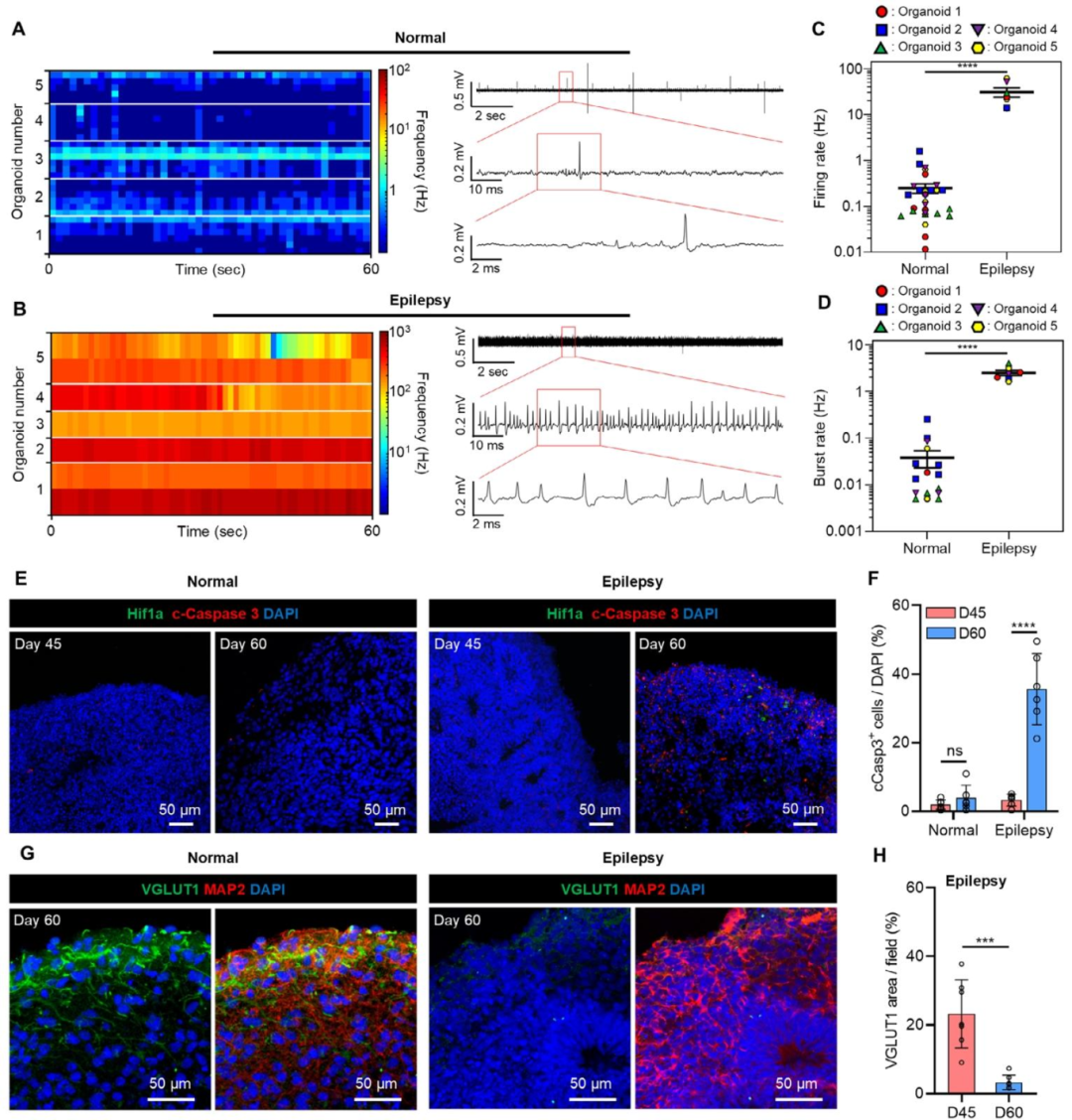 图 6：SCN2A 癫痫类器官的电生理与病理特征