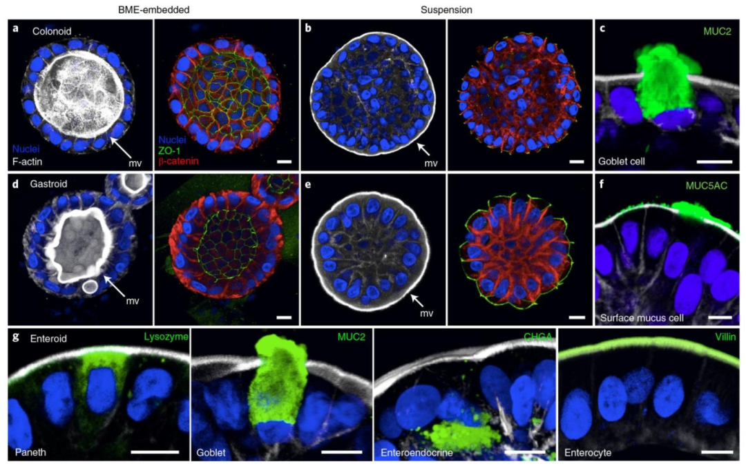 图 2：顶 - 外类器官的紧密连接与多谱系分化