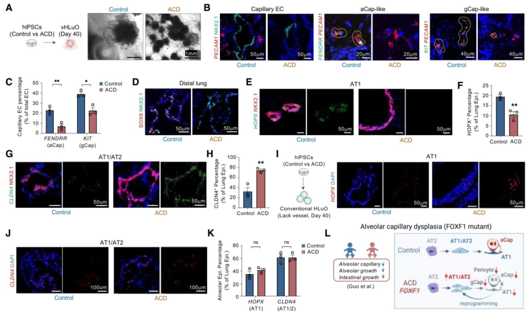 图 7：FOXF1 突变类器官模拟 ACDMPV 疾病表型