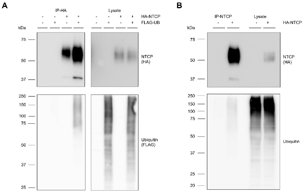 图 1：NTCP 可发生内源性泛素化修饰