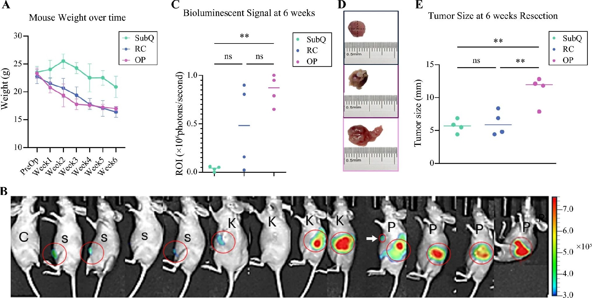 图2：三种移植模型的肿瘤生长与小鼠体重动态
