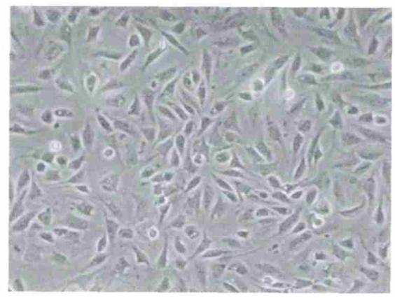 图2：培养 72h 的 KC 形态