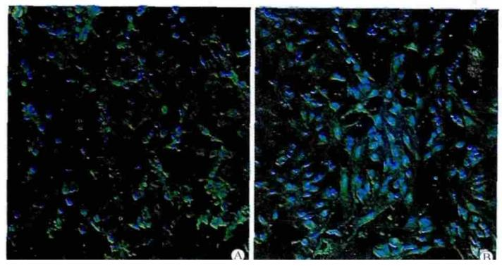 图3：KC 的 F4/80 免疫荧光鉴定