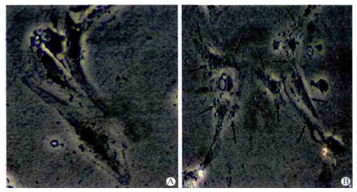 图4：KC 墨汁吞噬实验