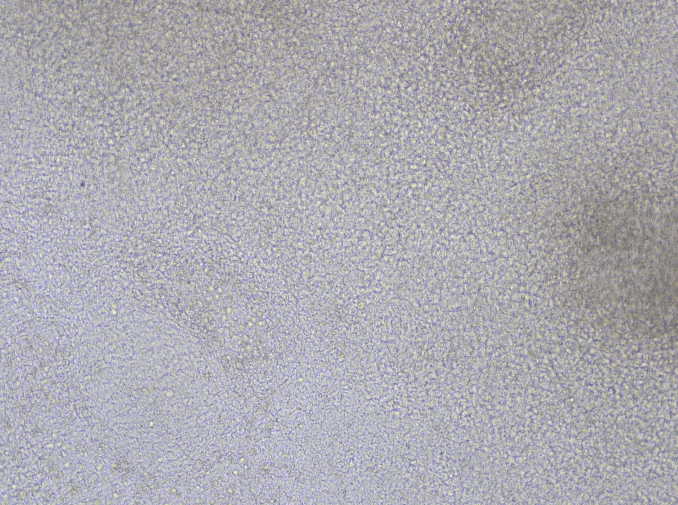 DAY 4-7:后中间中胚层阶段