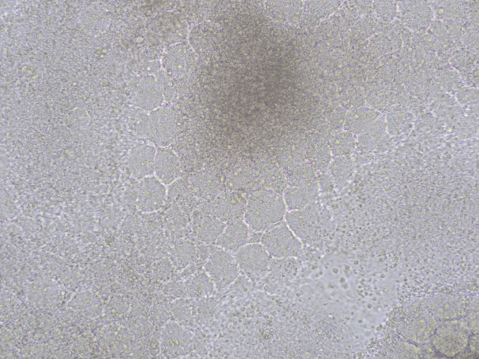 四、DAY 7-9: 肾祖细胞阶段