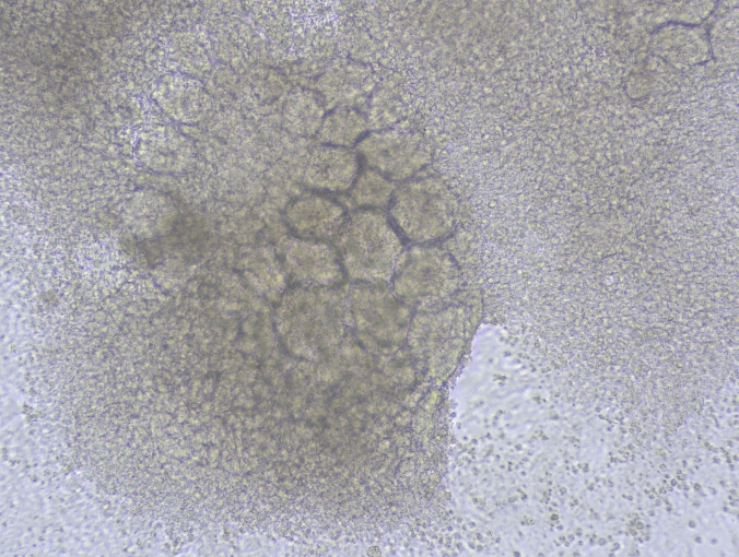 五、DAY 9-11: 肾小管前聚集体阶段