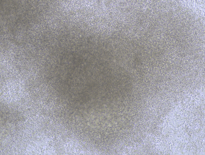 六、DAY 11-14: 肾小管前聚集体阶段