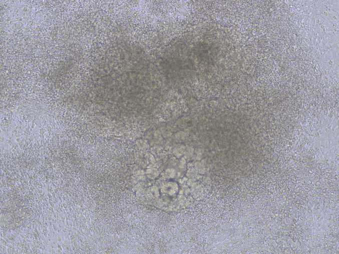 七、DAY 14-21或40: 肾类器官成熟阶段