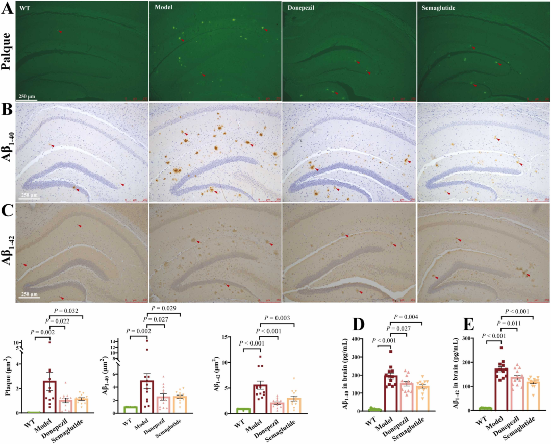 图2：索马鲁肽减少脑内Aβ斑块和Tau蛋白积累