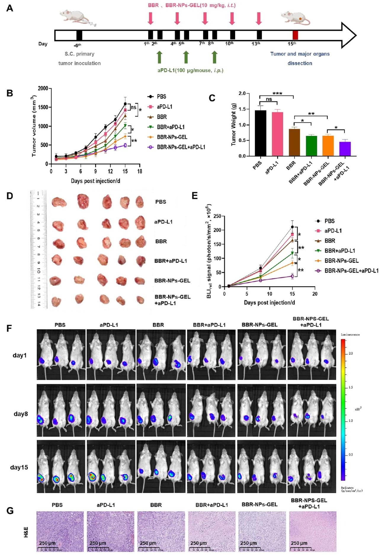 图 6：BBR-NPs-GEL增强aPD-L1的抗肿瘤疗效
