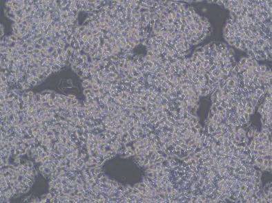 图2：在Laminin521上生长hESC 细胞使用hESC/iPSC Passage Solution(Enzyme containing)消化8min状态图。