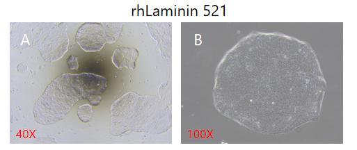图 1.使用O8培养基在rhLaminin 521上连续培养hESC(H1)20代后细胞形态图：(A)和(B ) 为培养至第20代，低倍镜和高倍镜下 H1 培养形态图示。