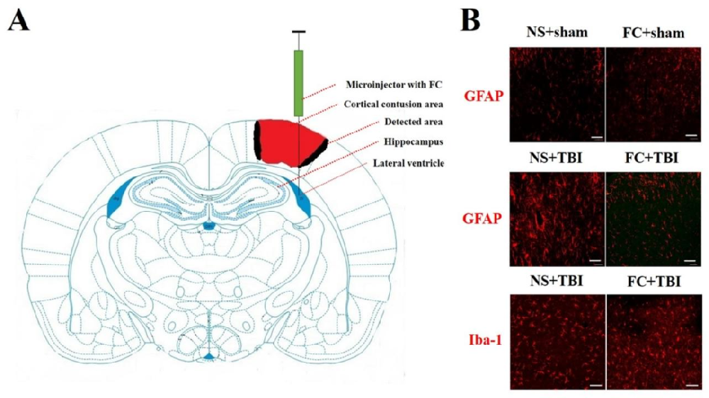 图1：FC 抑制 TBI 后星形胶质细胞激活