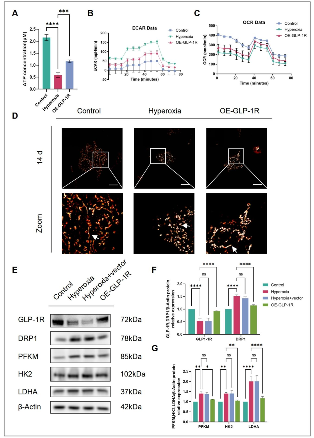 图6:GLP-1R 通过调控线粒体分裂和糖代谢促进肺发育
