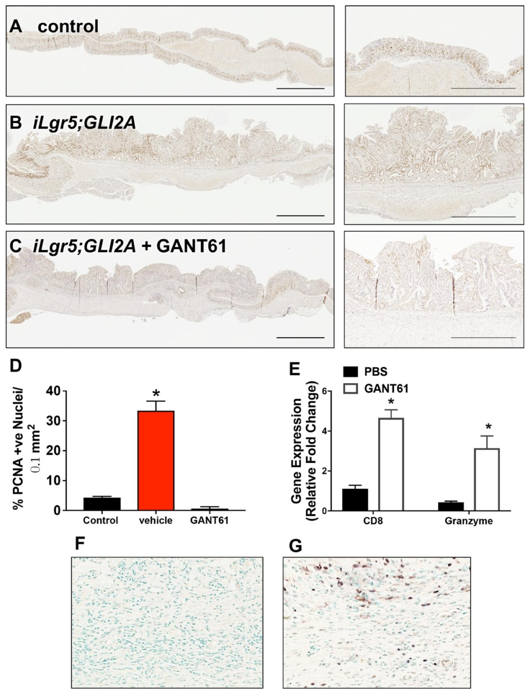 图 2：GANT-61 抑制小鼠胃癌细胞增殖并增加 CD8+ T 细胞浸润